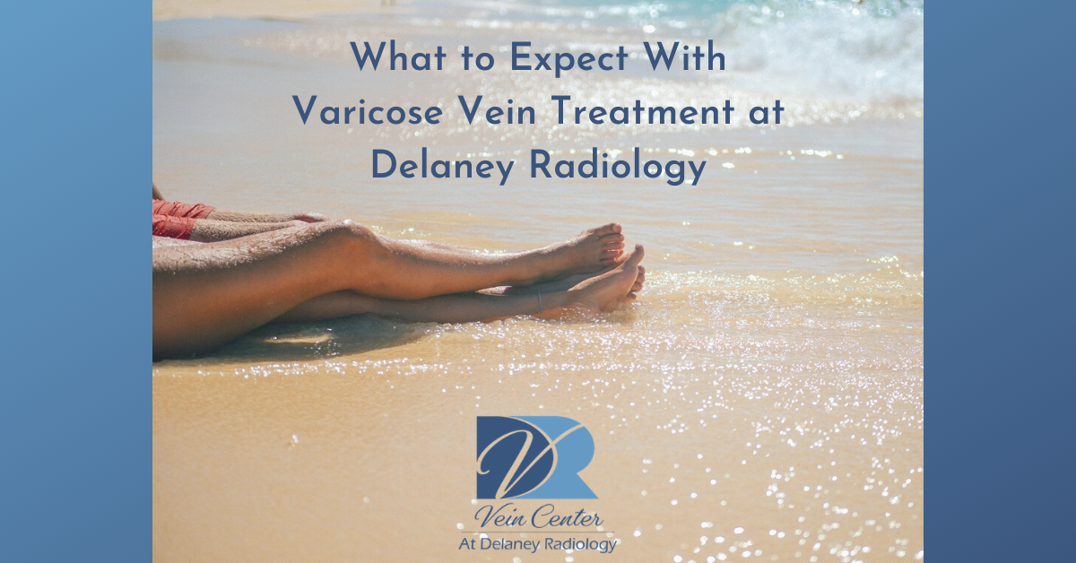 What to Expect With Varicose Vein Treatment at Delaney Radiology